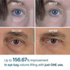 Clinical Results Before and After